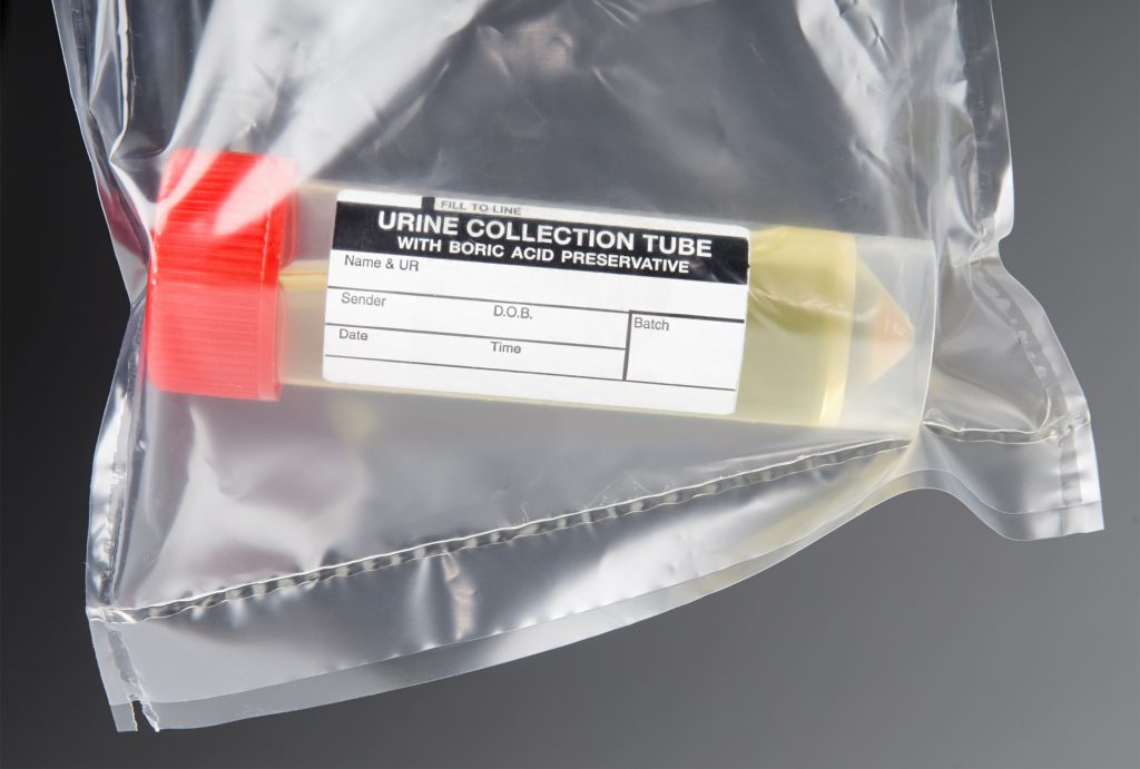 Urine Testing... Is it Reliable Evidence in a DUI Case?